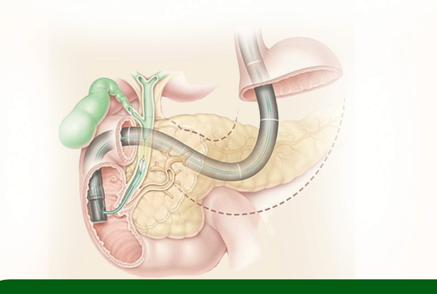 В наших центрах «Айболит» проводится дуоденальное зондирование. Рассказываем, что это такое 